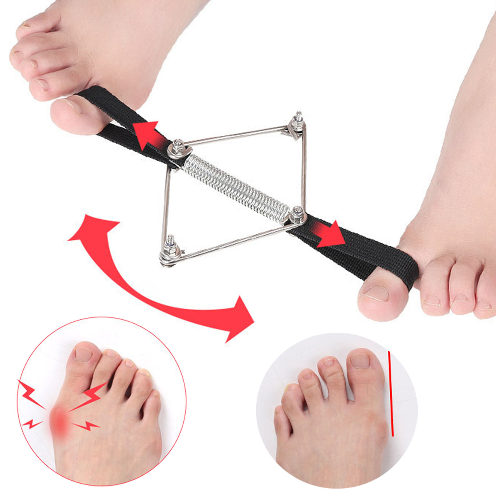 Bunion Corrector Nylon Steel S - Pilates Yoga Wellness ulasan dan harga